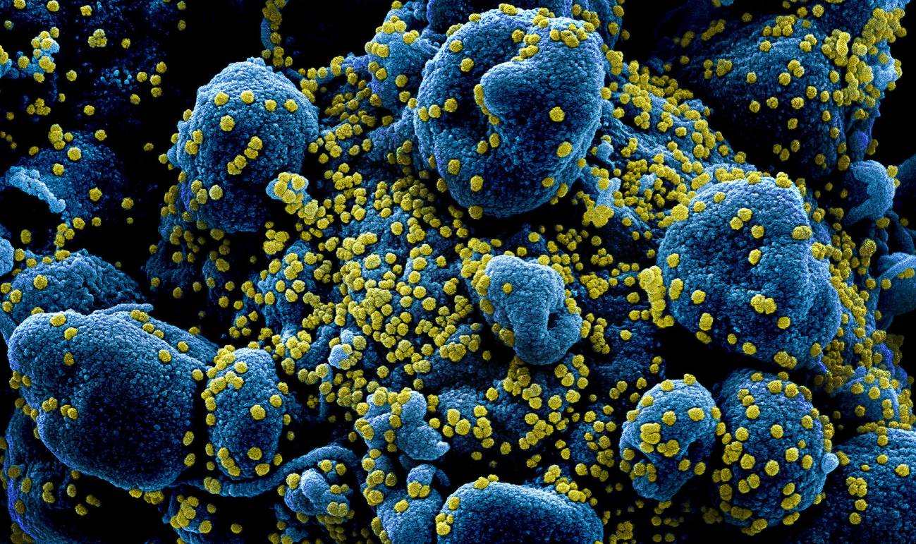 estudio-revela-que-hombres-son-mas-propensos-que-las-mujeres-a-morir-por-coronavirus