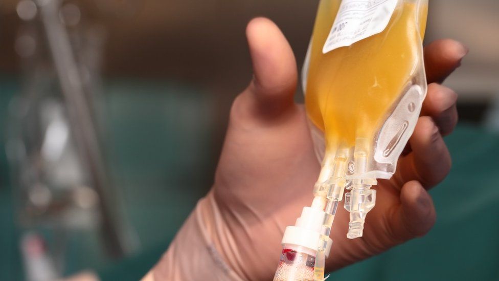 Médicos argentinos confirman que el uso de plasma logra resultados positivos en pacientes con coronavirus medicos-argentinos-confirman-que-el-uso-de-plasma-logra-resultados-positivos-en-pacientes-con-coronavirus
