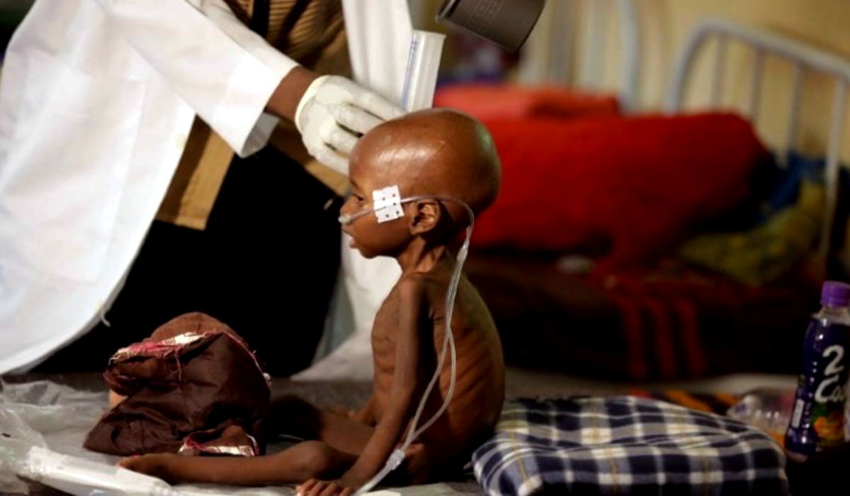 la-tragica-hambruna-que-viven-millones-de-personas-en-nigeria