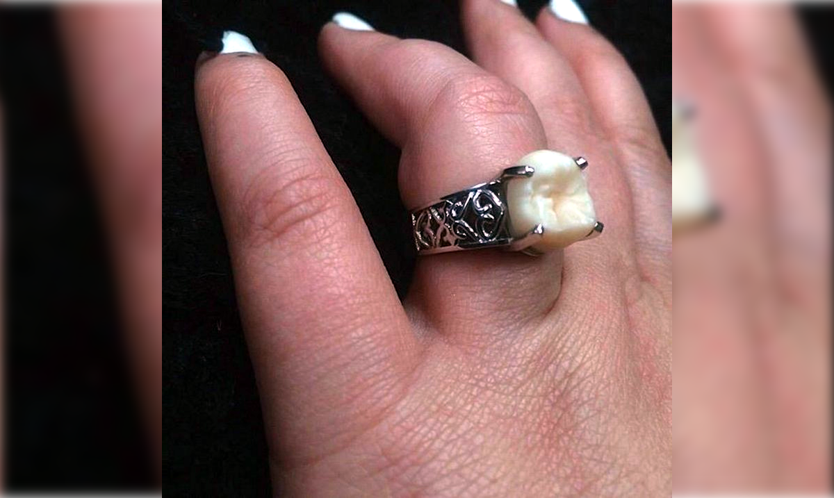 hombre-le-propone-matrimonio-a-su-novio-con-un-anillo-hecho-de-una-de-sus-muelas